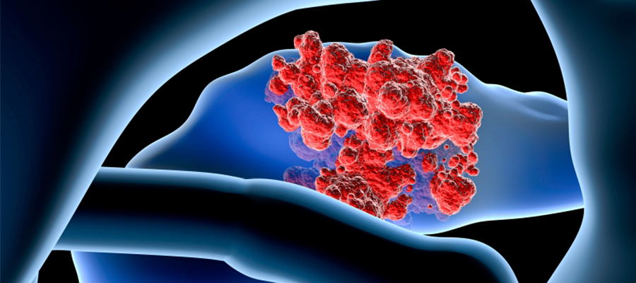 pancreas